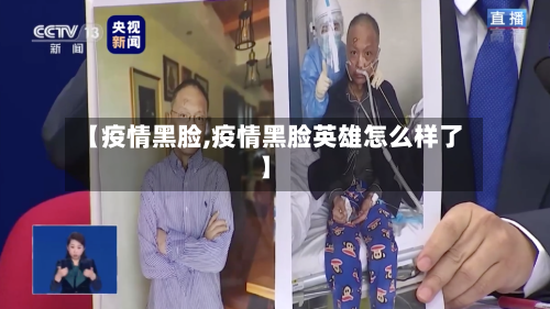 【疫情黑脸,疫情黑脸英雄怎么样了】