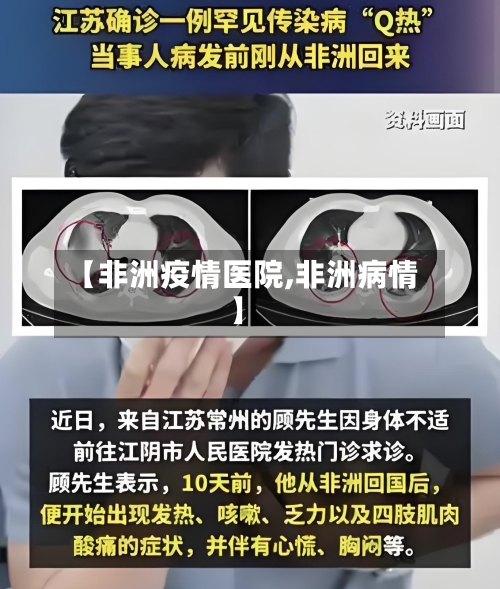 【非洲疫情医院,非洲病情】